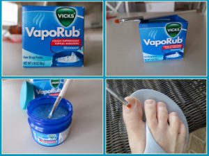 Vicks For Nail Fungus