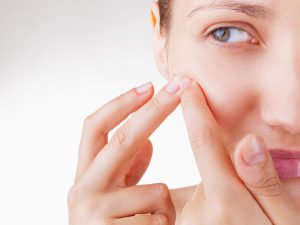 How to Remove Whiteheads on Face at Home