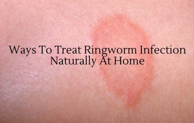 What Medicine Kills Ringworm