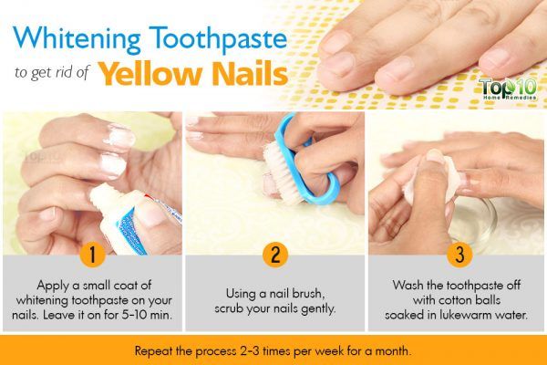 How to Whiten Nails | 17 Easy Home Remedies to Get Rid of Yellow Nails