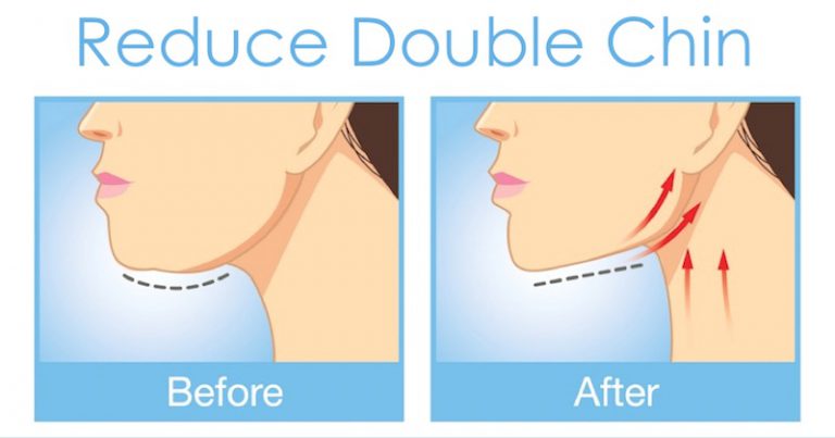 10 Most Effective Exercises To Get Rid Of A Double Chin Fast
